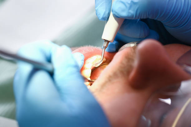 Best Emergency Dental Services for Seniors in Sardis City, AL