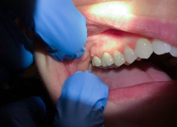Best Broken or Cracked Tooth Emergency Dentist in Sardis City, AL