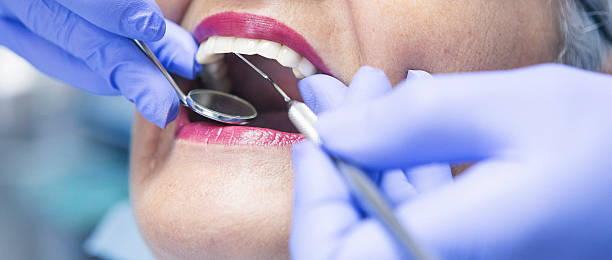 Best Emergency Dentist for Knocked-Out Tooth in Sardis City, AL